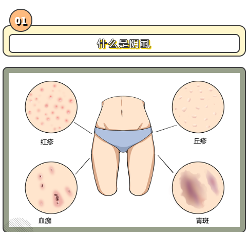 滄州男科檢查_私處癢癢癢，可能是這個小蟲子在作怪！(圖1)